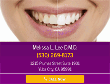 Tablet Screenshot of gentledentistyubacity.com